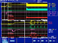 32 MW Long Memory and Dual Zoom